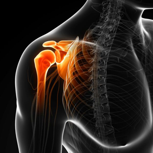 Chirurgie de l'épaule à bayonne et biarritz Chirurgie de l'épaule à bayonne et biarritz